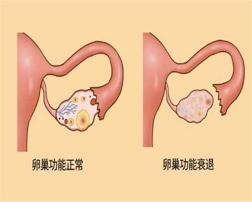 广州单身试管婴儿,单身试管婴儿